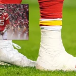 NFL, American Football Herren, USA AFC Divisional Round-Jacksonville Jaguars at Kansas City Chiefs Jan 21, 2023 Kansas City, Missouri, USA Kansas City Chiefs quarterback Patrick Mahomes 15 ankle is taped heavily during the second half in the AFC divisional round game at GEHA Field at Arrowhead Stadium. Kansas City GEHA Field at Arrowhead Stadium Missouri USA, EDITORIAL USE ONLY PUBLICATIONxINxGERxSUIxAUTxONLY Copyright: xJayxBiggerstaffx 20230121_gav_ba4_121